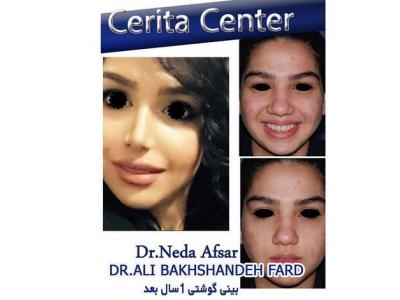 بورد-متخصص جراحی فک و صورت ، جراحی ایمپلنت و فک و بینی در تهران