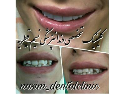 اصلاح-دندانپزشکی در منطقه یک تهران ،  کلینیک دندانپزشکی نسیم قیطریه