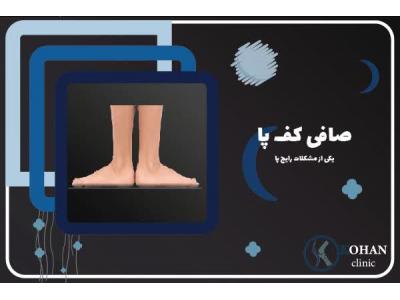 کفی طبی پونک-اسکن کف پا و کفی طبی غرب تهران – کلینیک تخصصی سلامت پا کهن