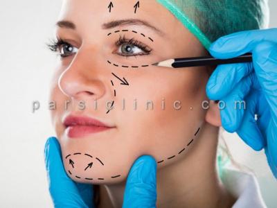 کلینیک زیبایی در تهران-جراحی زیبایی پلک