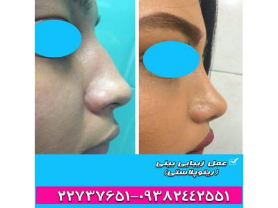کلینیک زیبایی در تهران-مرکز مشاوره تخصصی عمل زیبایی بینی در تهران