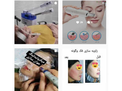 جراحی بینی و صورت-کلینیک زیبایی و لیزر دکتر مجتبی عقیلی در کردکوی