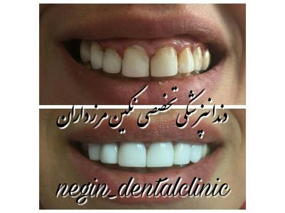 اصلاح-دندانپزشکی تخصصی  در مرزداران ،  دندانپزشکی تخصصی نگین مرزداران