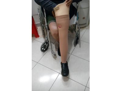 کاج-کلینیک تخصصی ساخت پای مصنوعی کرج
