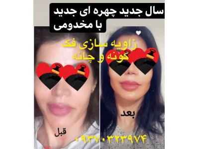 کرم های صورت-آموزش تخصصی حضوری و مجازی  ژل ، بوتاکس ، لیفت نخ نوشین مخدومی در مشهد و تهران