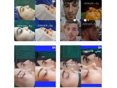 بدون درد- دکتر مهدی عرفانی متخصص جراح زیبایی در تهران
