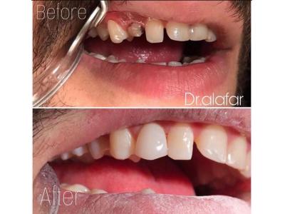 دندان-متخصص ارتودنسی و ایمپلنت   در ولنجک  