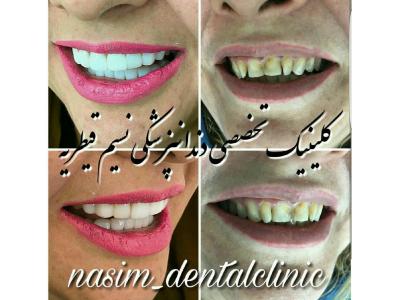 کلینیک زیبایی در تهران-دندانپزشکی در منطقه یک تهران ،  کلینیک دندانپزشکی نسیم قیطریه