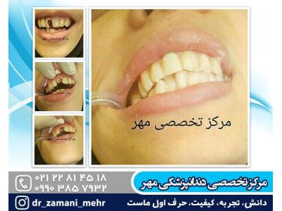 بیمار-بهترین دندانپزشکی در شمال تهران
