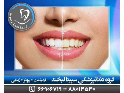 عصب‌کشی دندان-جراح لثه در تهران