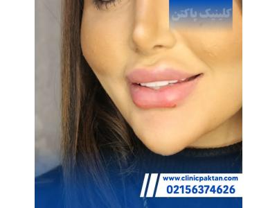 کلینیک لیزر موهای زائد محدوده واوان-بهترین  و مجهزترین کلینیک لیزر و زیبایی در اسلامشهر 
