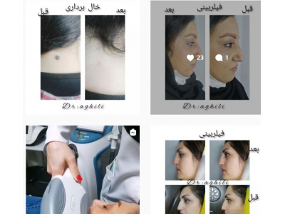 خدمات جراحی زیبایی-کلینیک زیبایی و لیزر دکتر مجتبی عقیلی در کردکوی