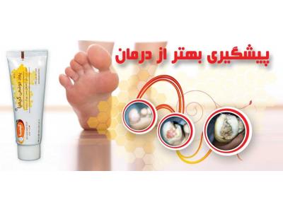 تولید و فروش جوراب-درمان انواع زخم های پوستی ، زخم بستر و زخم دیابت با پماد عسل کیمیا