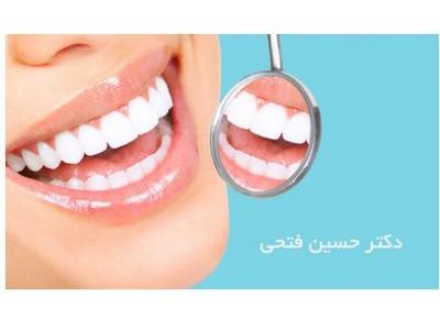 انواع کامپوزیت ساختمان-دکتر حسین فتحی جراح و دندانپزشک در تهران 
