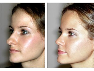 جراحی بینی و صورت-زیبایی فک  و صورت