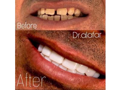 متخصص دندانپزشکی-متخصص ارتودنسی و ایمپلنت   در ولنجک  