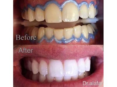 دندانپزشک متخصص-متخصص ارتودنسی و ایمپلنت   در ولنجک  
