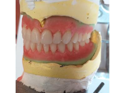 عصب‌کشی دندان-دندانسازی ولنجک
