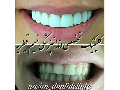 لنت کره-دندانپزشکی در منطقه یک تهران ،  کلینیک دندانپزشکی نسیم قیطریه