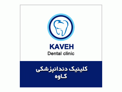 عصب‌کشی دندان-کلینیک تخصصی دندانپزشکی در قیطریه ،  ایمپلنت و کامپوزیت ونیر