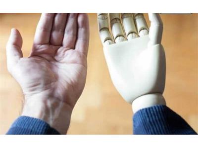 وزارت‌بهداشت-پروتز دست مصنوعی ، ساخت پروتز دست مصنوعی