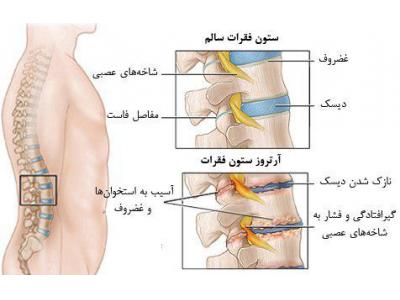 درمان سیاتیک-درمان سلولی   دیسک کمر و گردن  و آرتروز زانو  با لیزر سلولی در محدوده بلوار فرحزادی و غرب تهران