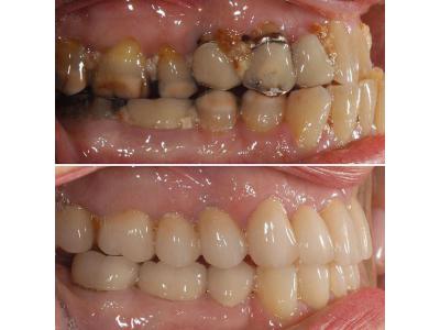 HSE-مرکز کاشت دندان و زیبایی