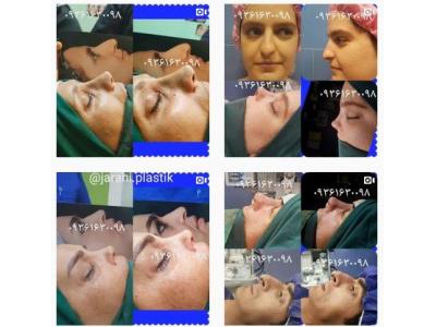 خدمات تلفنی- دکتر مهدی عرفانی متخصص جراح زیبایی در تهران