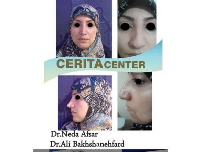 AND-جراحی زیبایی بینی ، جراحی فک و ایمپلنت در تهران 