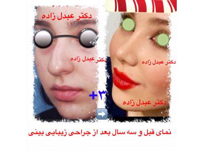 زیبایی در تهران-جراحی و زیبایی ترمیمی ، جراحی زیبایی بینی  ،  پیکرتراشی به روش لیزر لیپولیز و لیپوماتیک