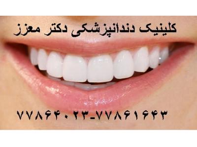درمان-کلینیک دندانپزشکی دکتر محمدرضا معزز جراح ، دندانپزشک متخصص ایمپلنت در تهرانپارس