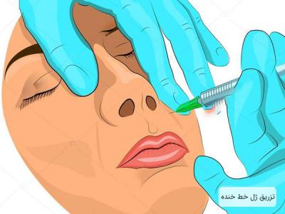 کلینیک تخصصی جراحی زیبایی-بوتاکس در شیراز