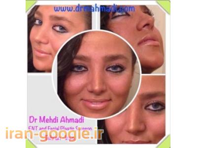 زیبایی-بهترین جراح زیبایی بینی  best iran rhinoplasty 