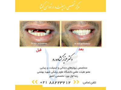 شمال شرق تهران و شمال تهران-مركز تخصصي دندانپزشكي گيشا