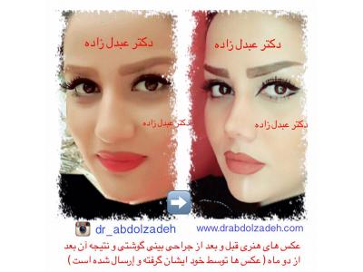 بازار پلاستیک تهران-جراحی و زیبایی ترمیمی ، جراحی زیبایی بینی  ،  پیکرتراشی به روش لیزر لیپولیز و لیپوماتیک