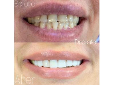 دندان پزشک-متخصص ارتودنسی و ایمپلنت   در ولنجک  