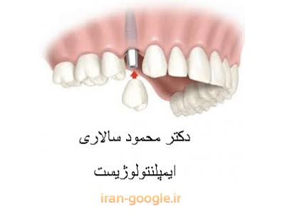 دندانپزشکی- مرکز تخصصی ایمپلنت و زیبایی دکتر محمود سالاری