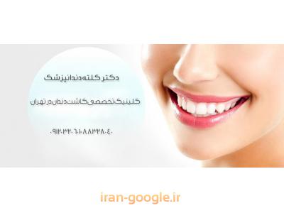 لیو-جراح ایمپلنت های دندانی و دندانپزشک در تهران 