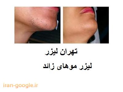 پوستی-تهران لیزر کلینیک  تخصصی لیزر موهای زائد ، جوانسازی و لایه برداری پوست 