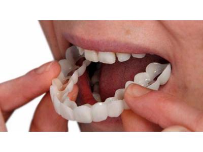 زیبایی دهان و دندان-کلینیک دندانپزشکی دکتر محمدرضا معزز جراح ، دندانپزشک متخصص ایمپلنت در تهرانپارس