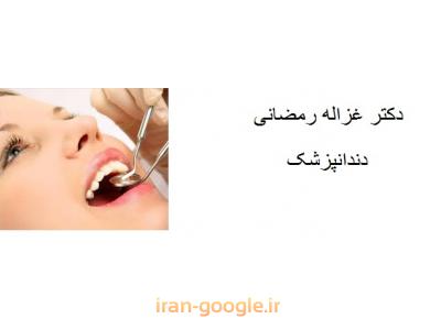 متخصص ایمپلنت دندان-دکتر غزاله رمضانی متخصص پروتز ثابت و متحرک ، ایمپلنت و طراحی لبخند