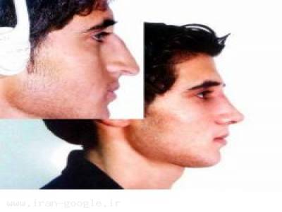 جوانسازی پوست صورت-جراحی پلاستیک بینی و صورت با کمترین درد