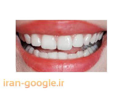 دندان سفید-مرکز تخصصی دندانپزشکی