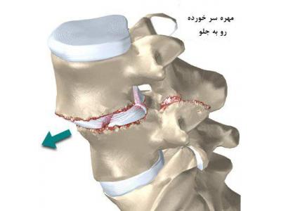 نما مدرن-درمان سلولی   دیسک کمر و گردن  و آرتروز زانو  با لیزر سلولی در محدوده بلوار فرحزادی و غرب تهران
