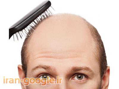 سرطان-درمان گیاهی و کامل موخوره شوره سر شکنندگی موهای آسیب دیده با پک شامپو و لوسیون ژیوار