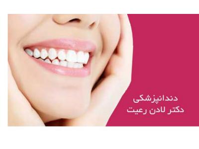 عصب‌کشی دندان-کلینیک دندانپزشکی دکتر لادن رعیت - جراح و دندانپزشک زیبایی