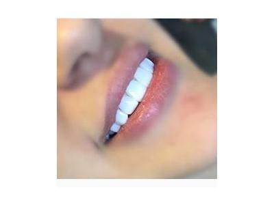 متخصص ایمپلنت دندان-کلینیک دندانپزشکی و دندانسازی  نکو  در محدوده اشرفی اصفهانی