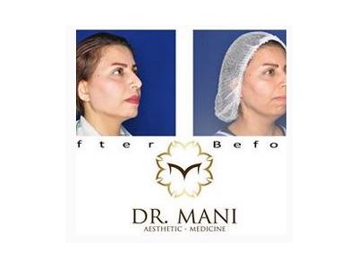 کار جدید-دکتر مانی جمالی متخصص پوست و مو   در نیاوران 