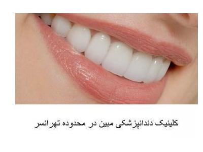 انواع دستگاه پرس-کلینیک تخصصی دندانپزشکی مبین در تهرانسر