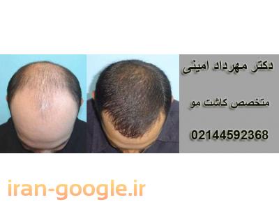 درمان بی عارضه- پوست و مو ، کاشت مو ، پاکسازی و لایه برداری صورت